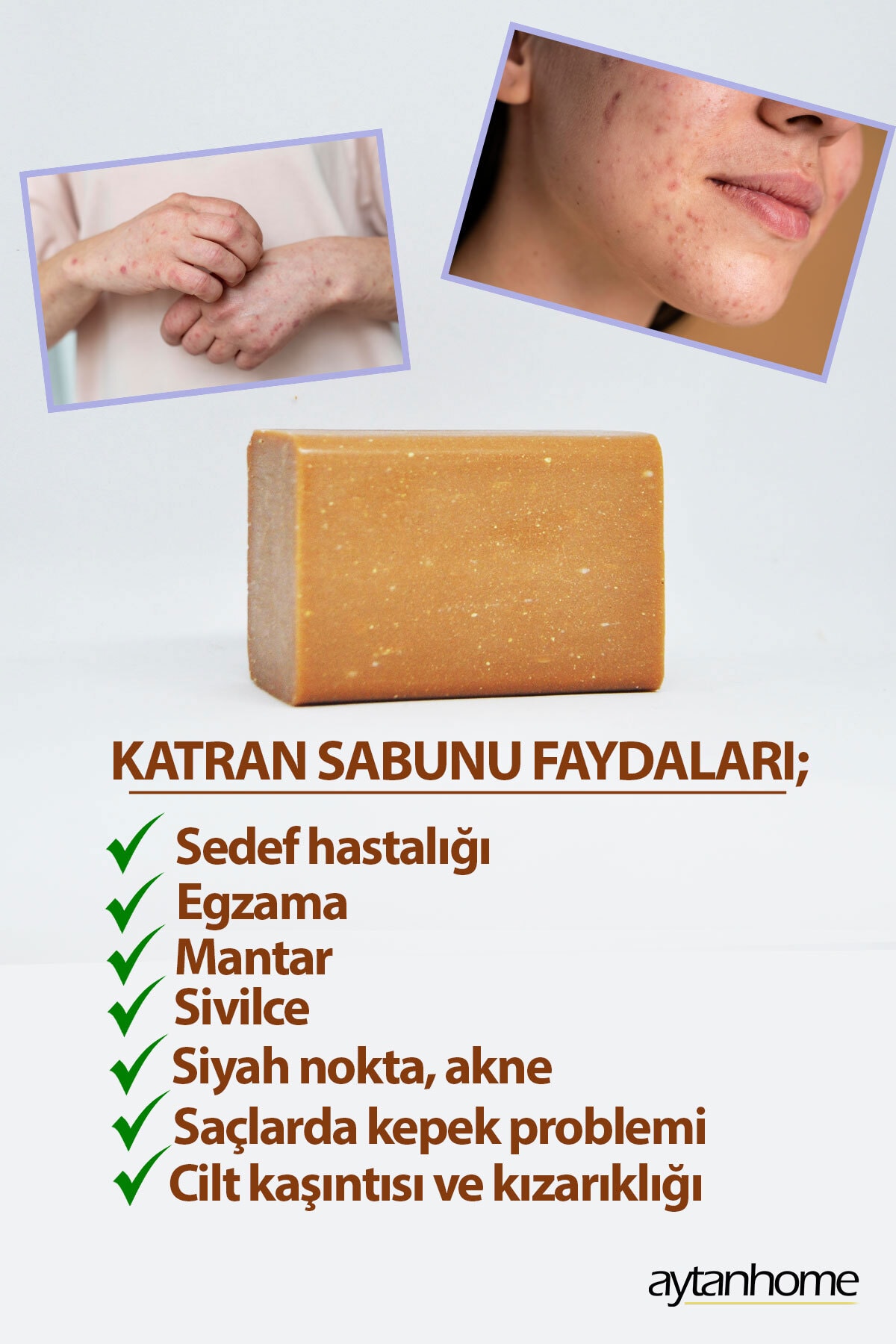 Katran Sabunu Kükürt Içerikli (sedef, Egzama, Sivilce, Mantar, Kepek) Bakım Sabunu 90gr.